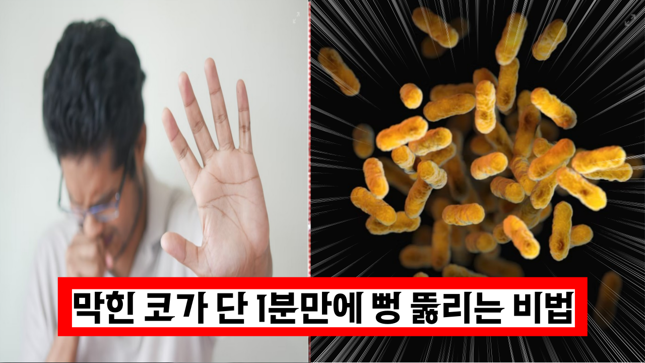  '비염 있으신분 필독' 막힌 코 1분만에 뻥 뚫리게 하는 비법