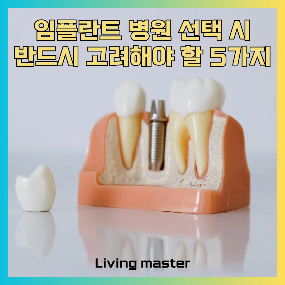 임플란트 병원 선택 시 반드시 고려해야 할 5가지