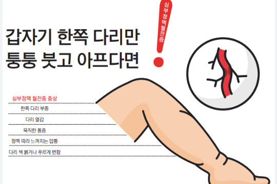 심부정맥혈전증