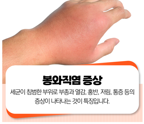 봉와직염에 걸린 손 사진과 밑에 증상을 적어둔 내용