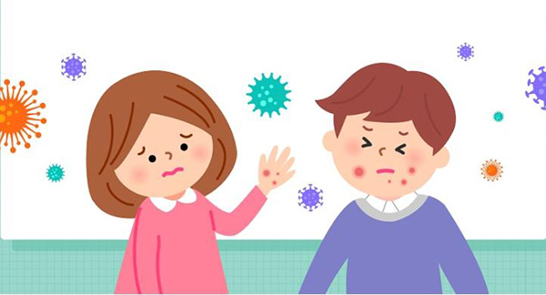  우리아이 입과 손에 물집이 생겼다면? 수족구병