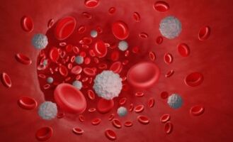 Eosinophil 수치