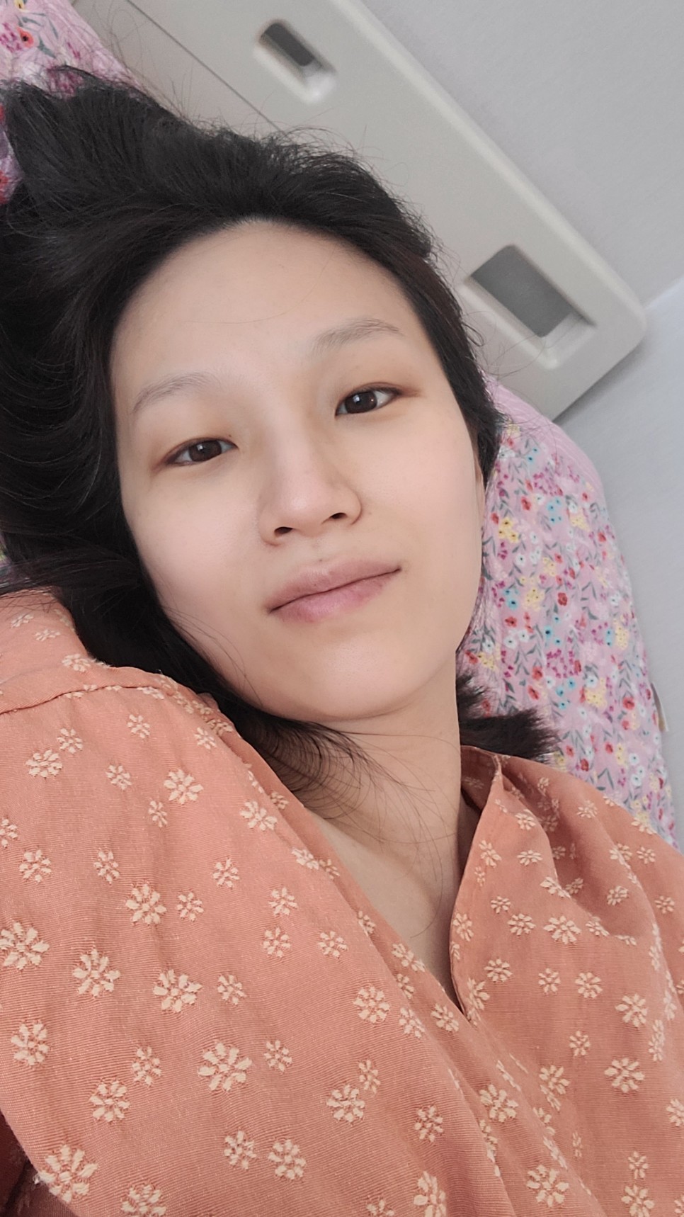 제왕절개 1일차 _ 제왕절개는 이런