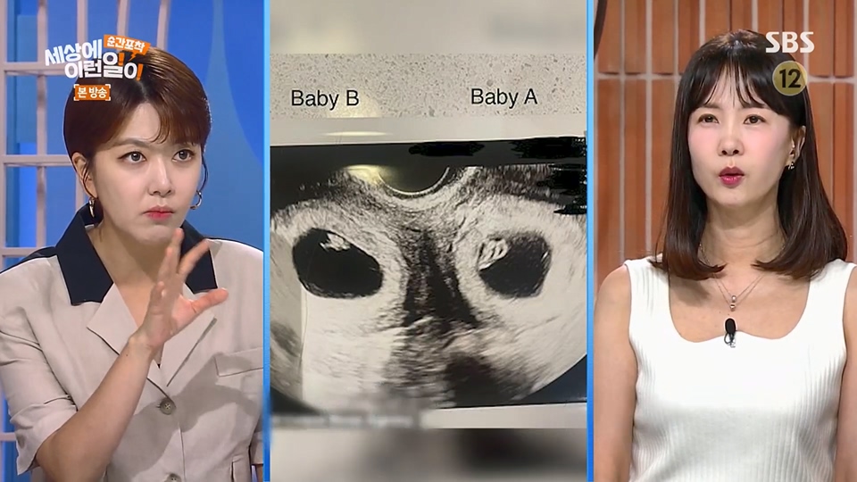 순간포착 세상에 이런일이.E1236.230708p.H264-F1RST.mp4_20230709_171115.093.jpg