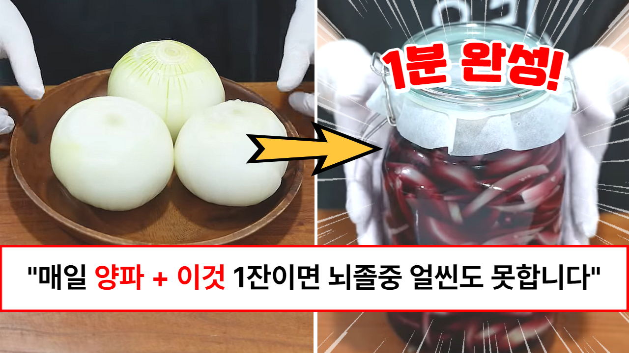“만원짜리 양파로 무병장수하세요” 1분이면 완성되는 항암, 항염, 혈관청소부 양파와인 만드는 레시피