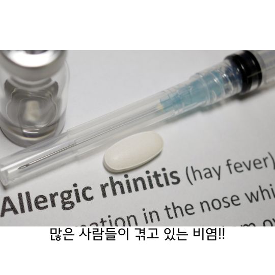  비염 일상 생활에 불편함을 주는 질환