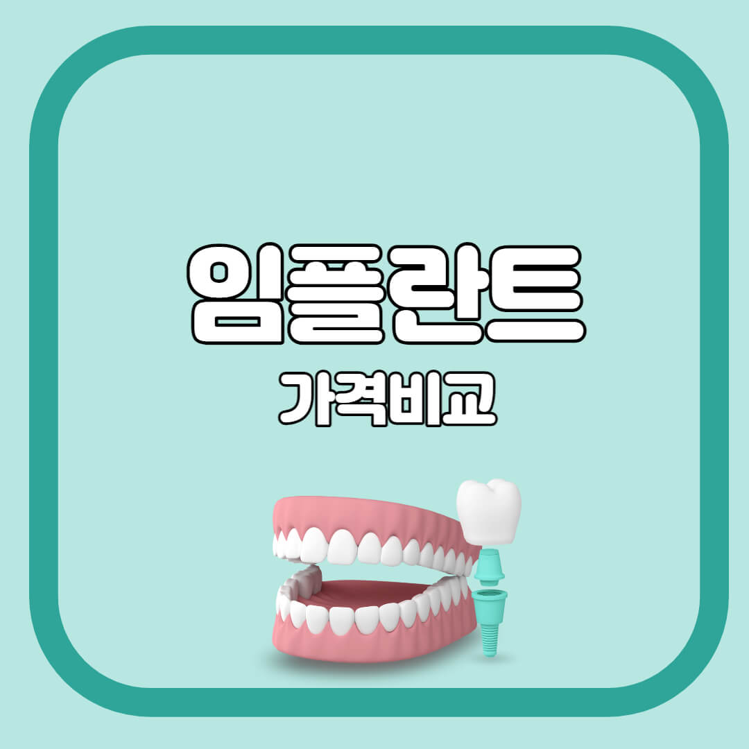  임플란트 가격비교 총정리