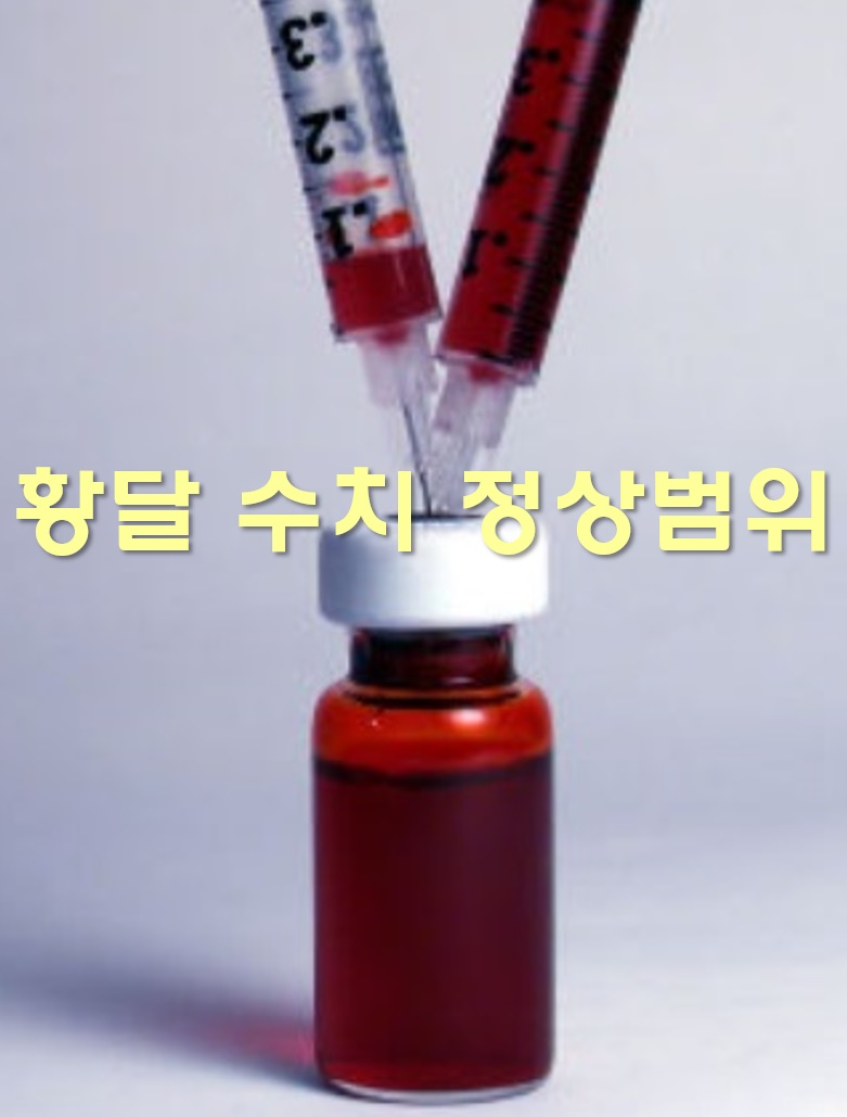  황달 수치 정상범위와 치료 방법