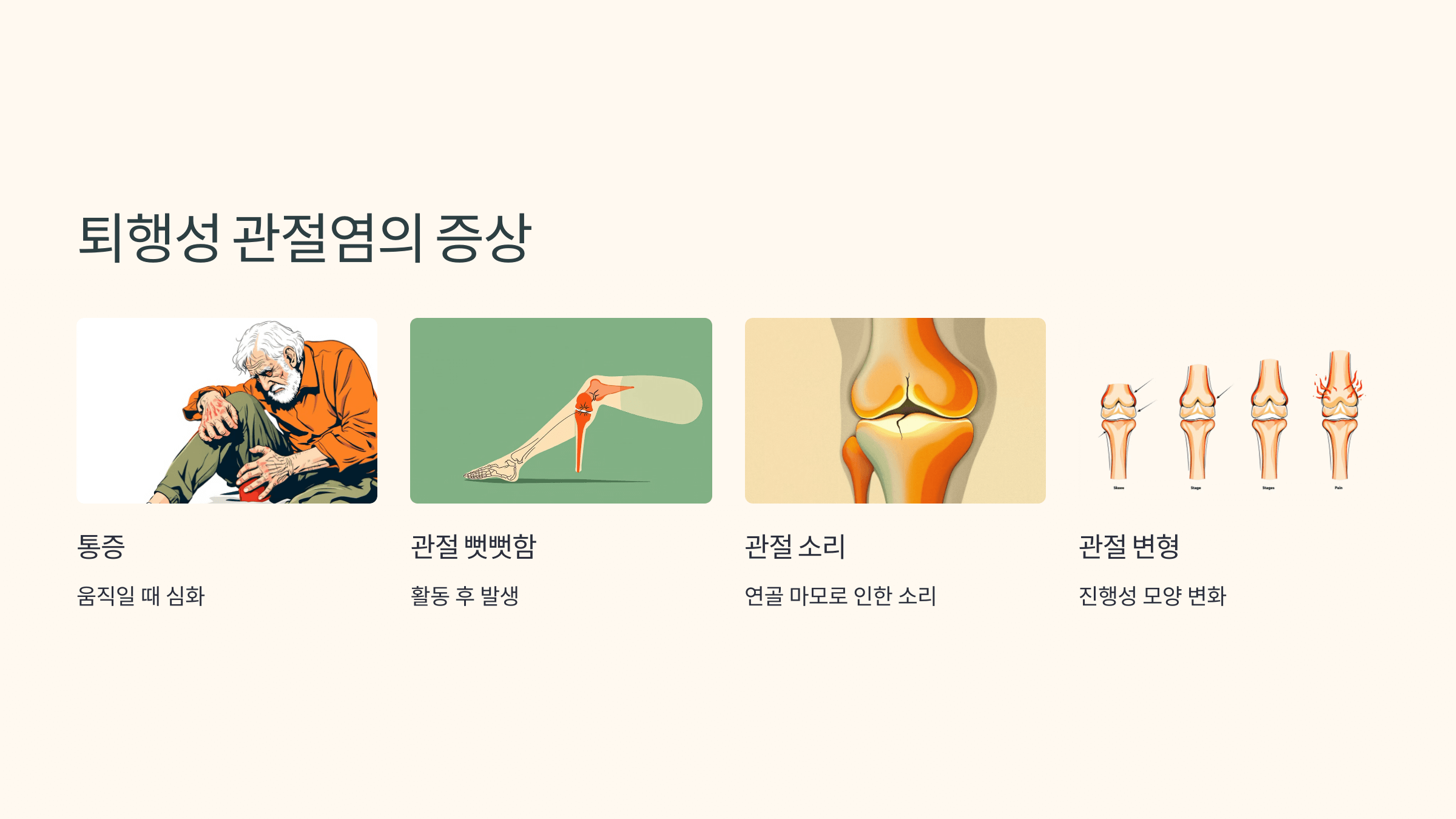 관절염과 관련된 사진입니다.