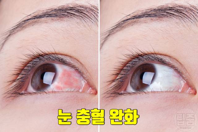 다슬기 효능 부작용 눈 충혈 시력보호