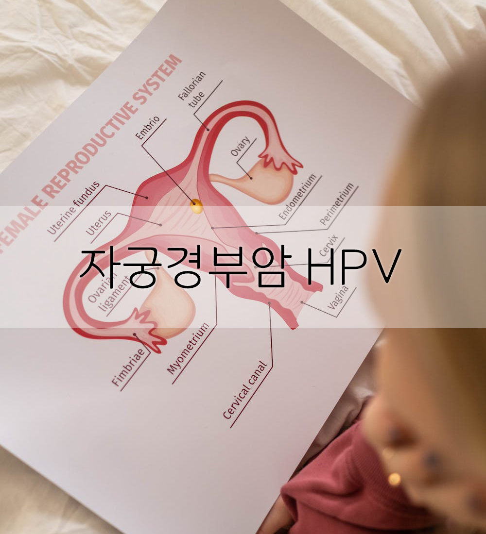  자궁경부암 HPV 예방 및 무료 접종 대상은? (가다실4가, 9가, 서바릭스)