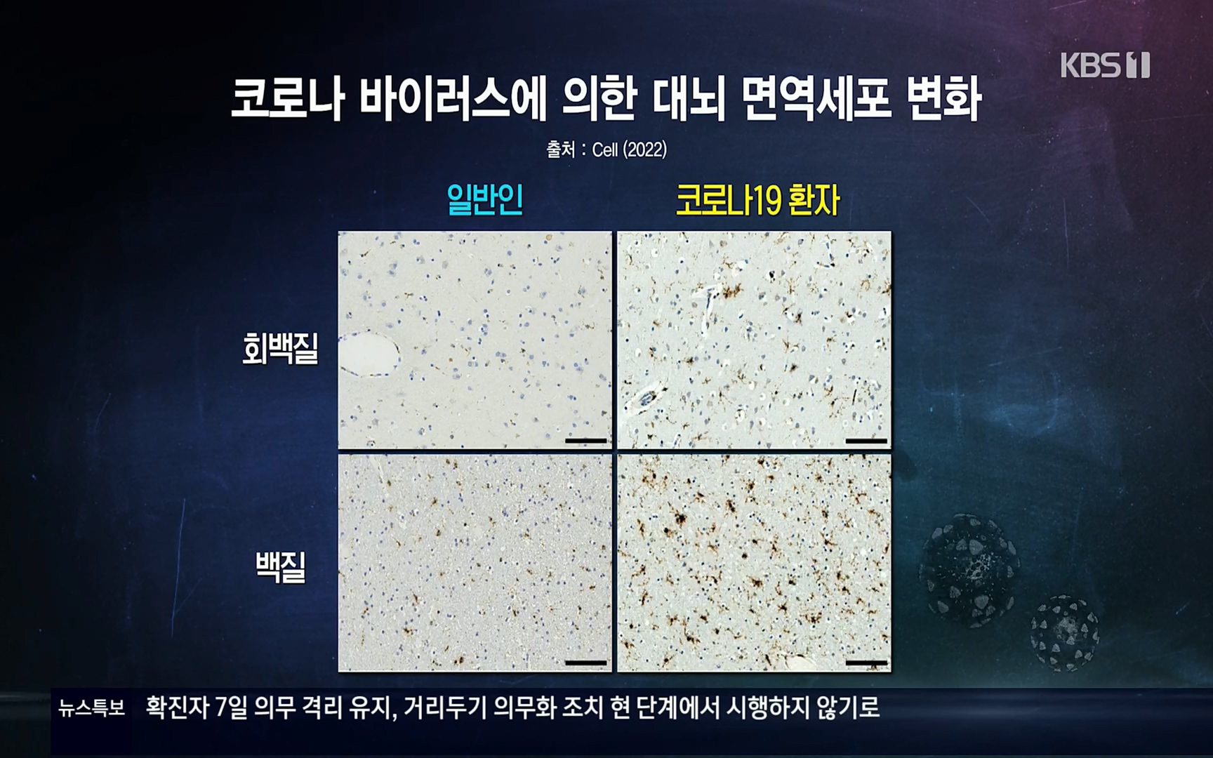 생로병사의 비밀.E827.220720p.H264-F1RST.mp4_20220721_201924.036.jpg