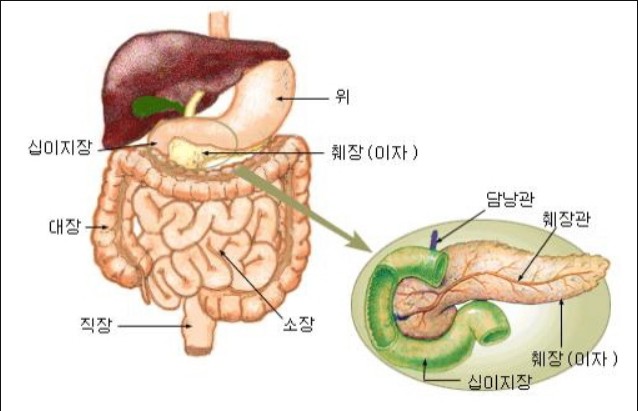  췌장암 초기증상과 검사방법, 당뇨병과 관계 있을까?