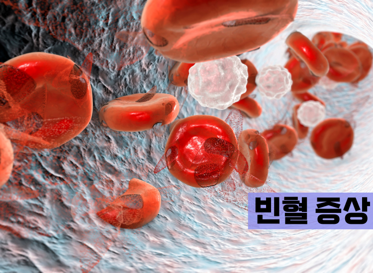 빈혈 증상