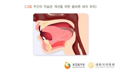  올바른 혀의 위치.jpg