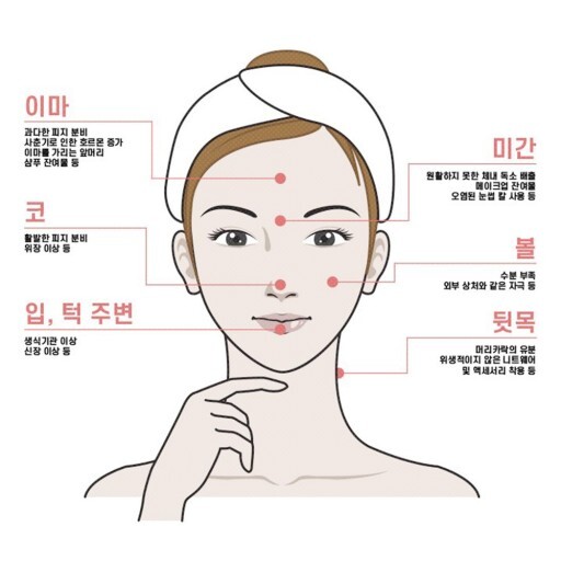  이마 좁쌀 여드름 원인 알고 도자기 피부 되자!!!