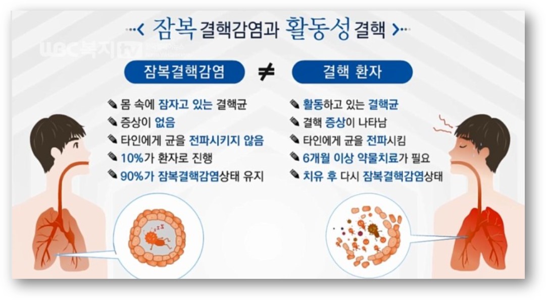 잠복성 결핵과 활동성 결핵 f. wbc복지TV