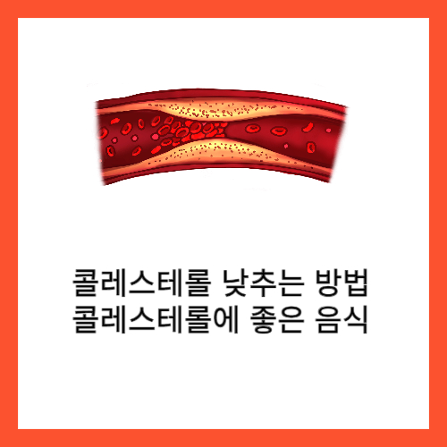 콜레스테롤이-무엇인지-콜레스테롤을-낮추는-방법-콜레스테롤에-좋은-음식에-대하여-알아보자.