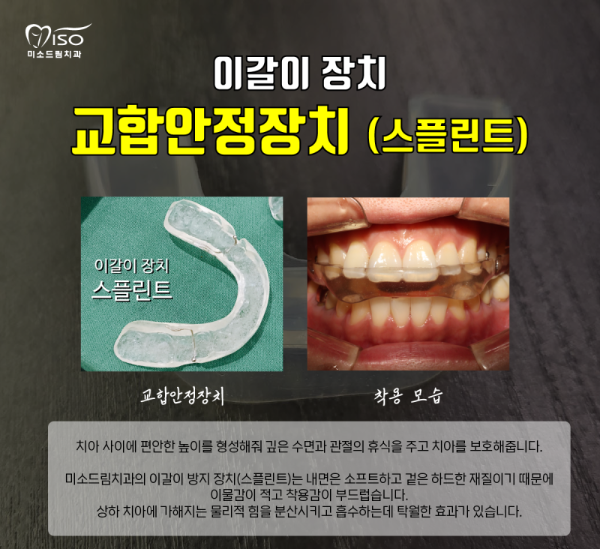 흔들리는 치아 - 이갈이 교합안전장치