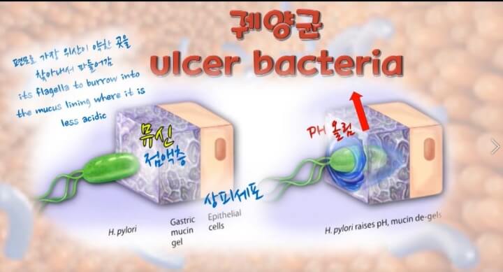 헬리코박터가 파고드는 모습