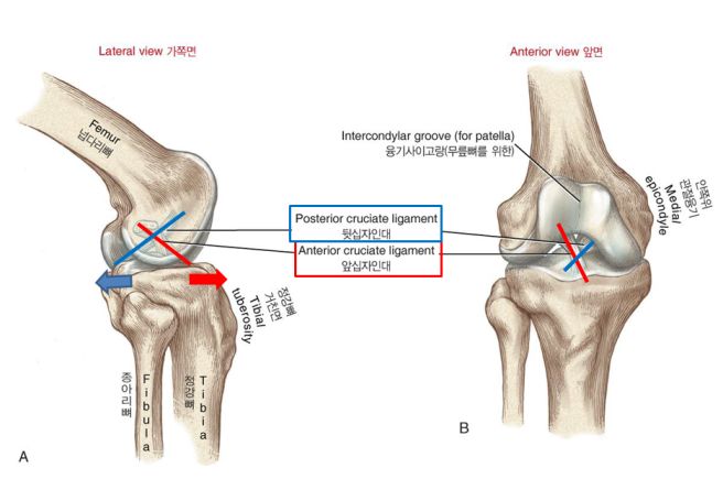 전방십자인대 파열 증상