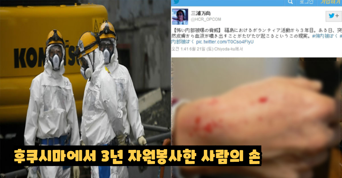  후쿠시마에서 자원봉사하던 사람의 상태