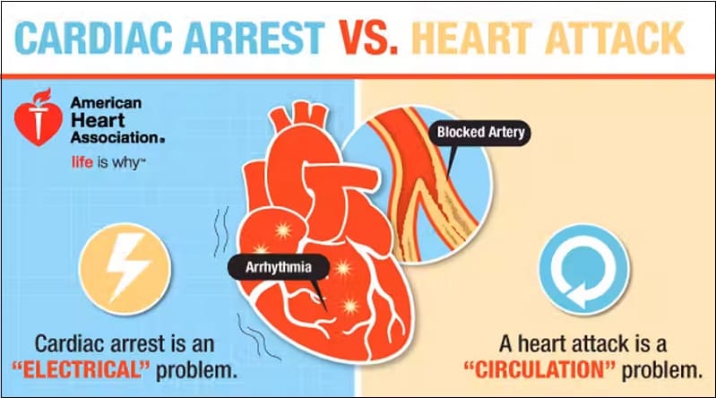 심장마비와 심정지의 차이 What&#39;s the difference between a heart attack and cardiac arrest?