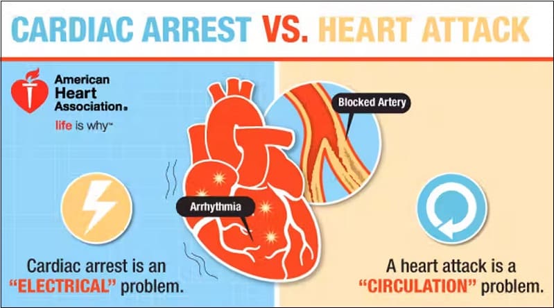  심장마비와 심정지의 차이 What's the difference between a heart attack and cardiac arrest?