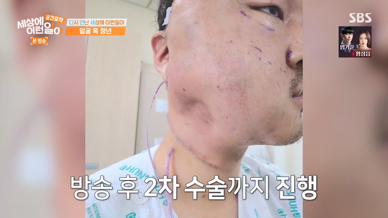 순간포착 세상에 이런일이.E1269.240317p-NEXT.mp4_20240317_163616.892.jpg