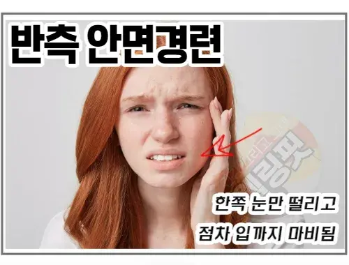 반측-안면경련이-있으면-얼굴-반쪽에서-마비증상이-오며-눈이-파르르-떨립니다.