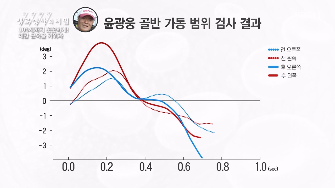 생로병사의 비밀.E885.231012p-NEXT.mp4_20231012_203452.202.jpg