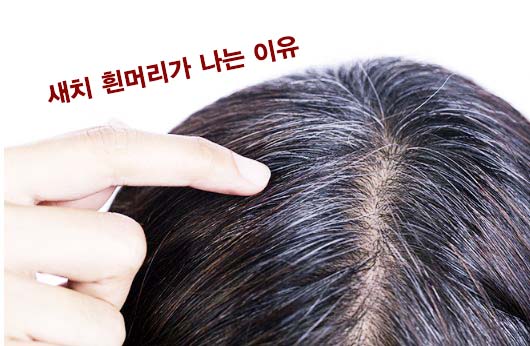  새치 흰머리가 나는 이유