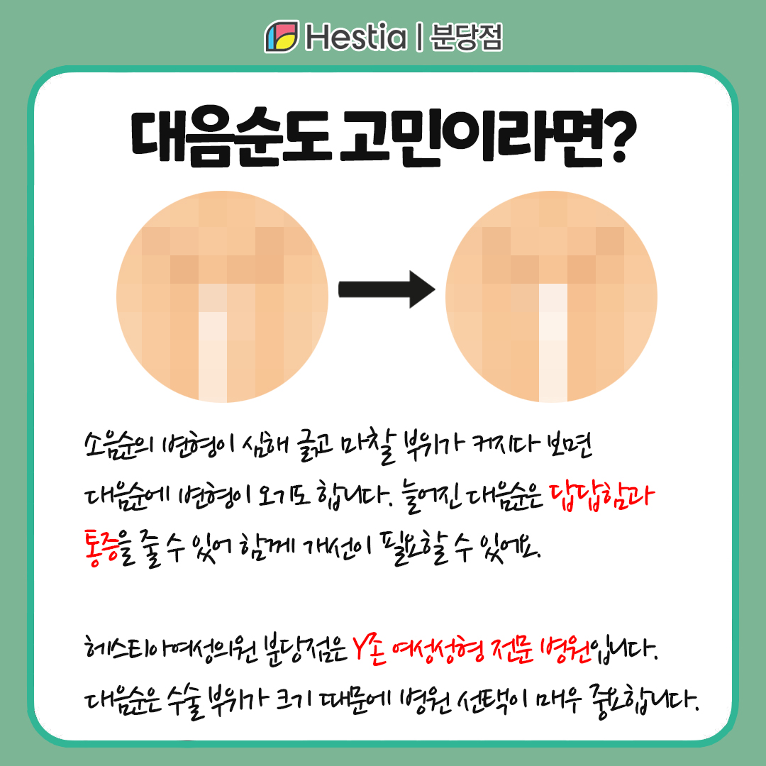 여자소음순 소음순 늘어짐 소음순성형수술 함께 개선할 수 있는 부위