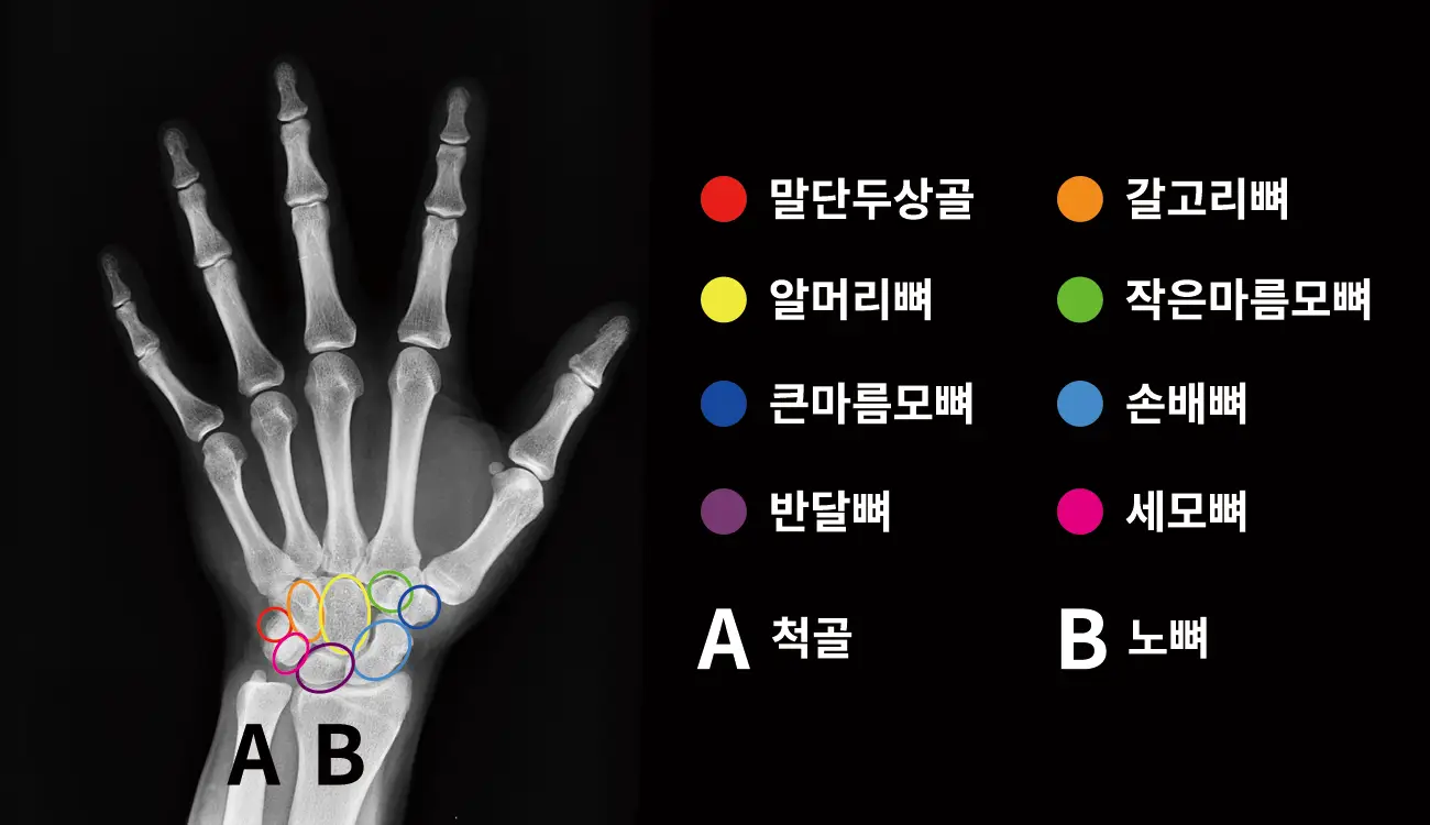 손목뼈-수근골-8개-척골-노뼈