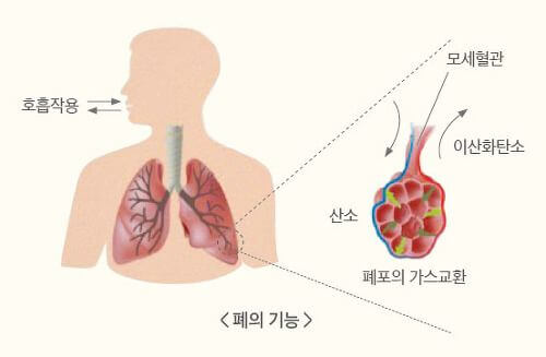 폐렴 증상