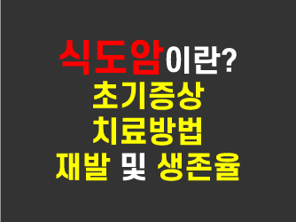  식도암이란? 발생 원인과 초기증상 및 치료와 수술 부작용 정리.