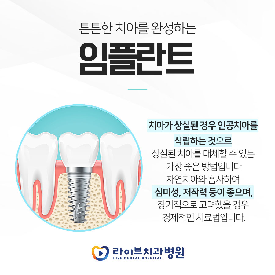 강남역임플란트