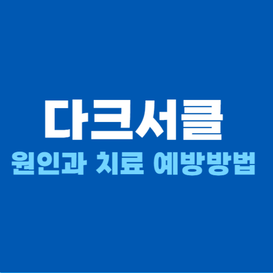 다크서클 원인 치료 예방 방법