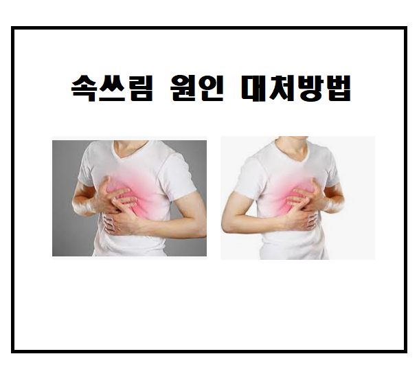  속쓰림 증상 원인 대처방법 총정리!