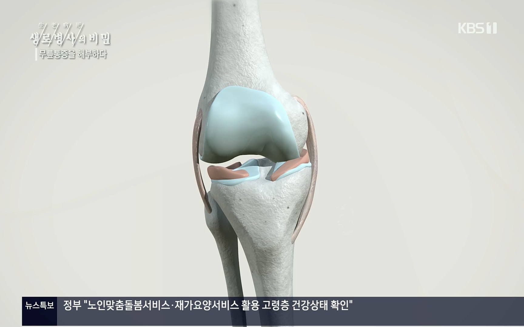 생로병사의 비밀.E834.220907p.H264-F1RST.mp4_20220908_210424.794.jpg