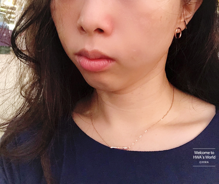 콧볼 축소 비용 [강남/보톡스] 콧볼축소주사-후기 4