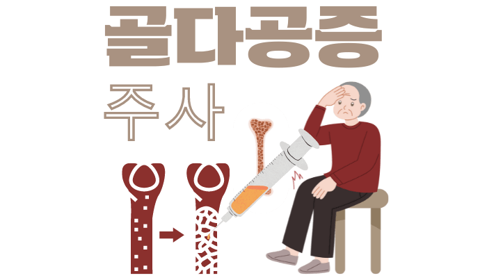 골다공증 주사와 비용-주사주기와 예방