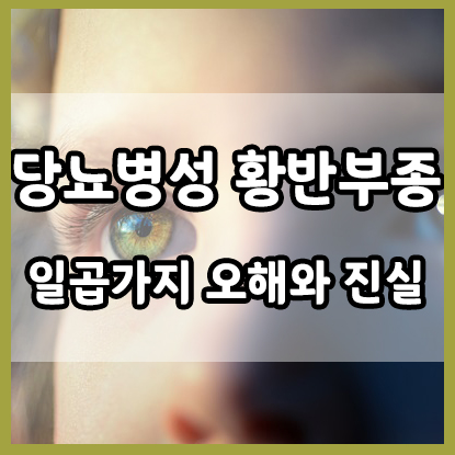  당뇨병성 황반부종에 대한 일곱 가지 오해!