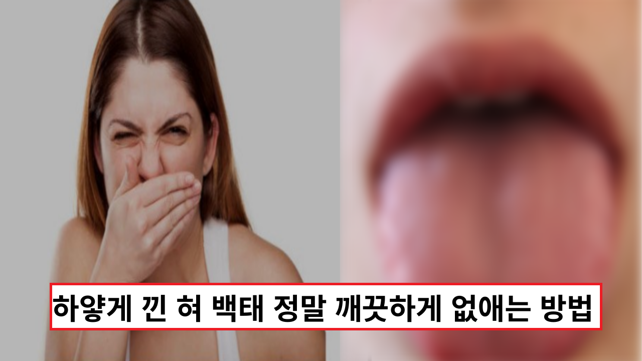  '입냄새의 원인' 하얗게 낀 혀 백태 정말 깨끗하게 없애는 방법
