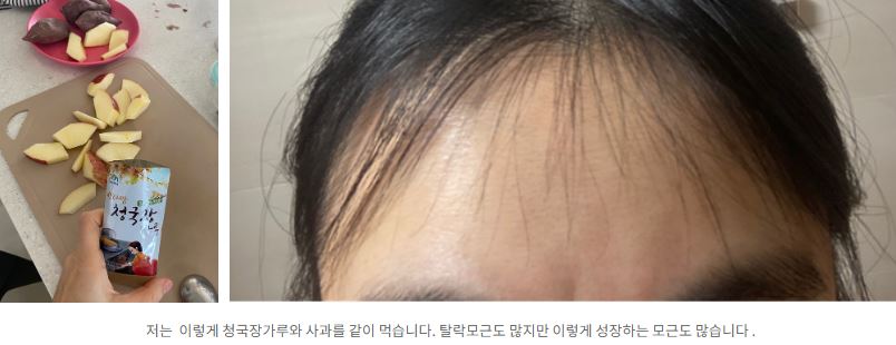 만성염증