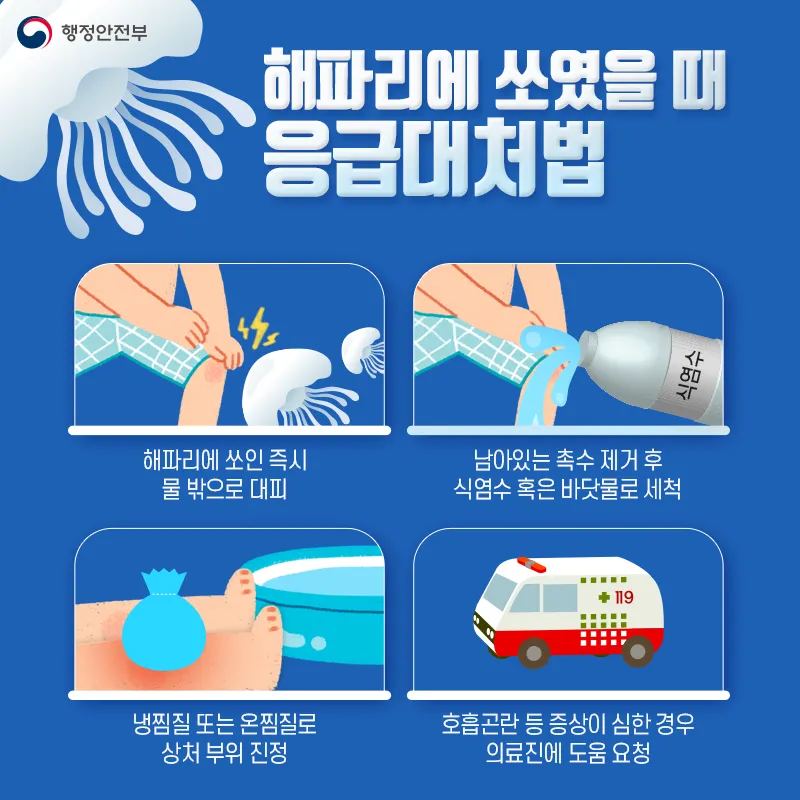 해파리-쏘임-응급대처법