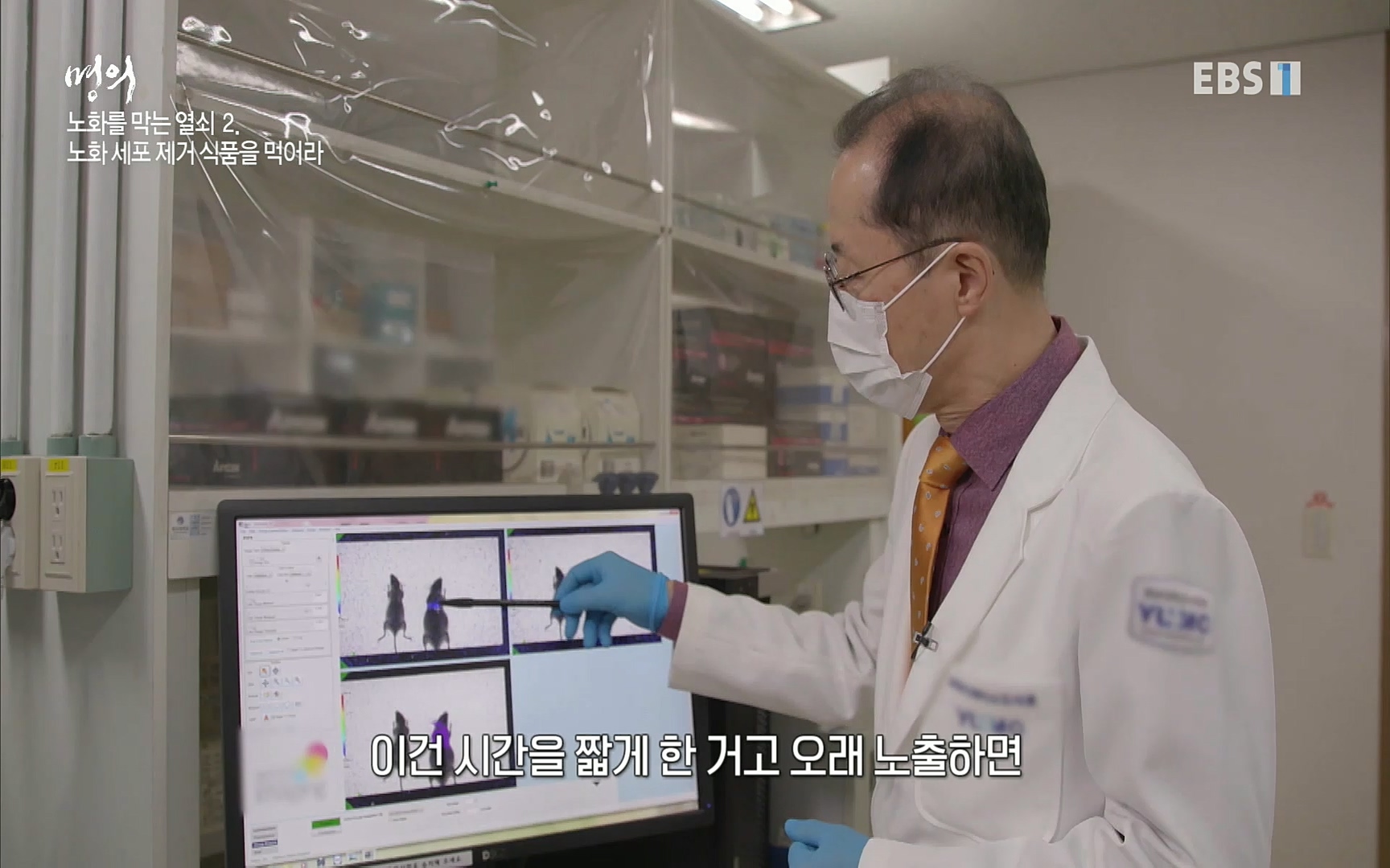 EBS 명의 헬스케어 - TV - 교육의 중심 EBS노화를 막는 다섯가지 열쇠.mp4_20220725_203748.494.jpg