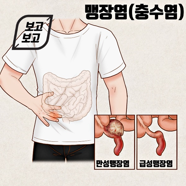 맹장은-남자나-여자나-모두-오른쪽-아랫배에-위치하고-있습니다.