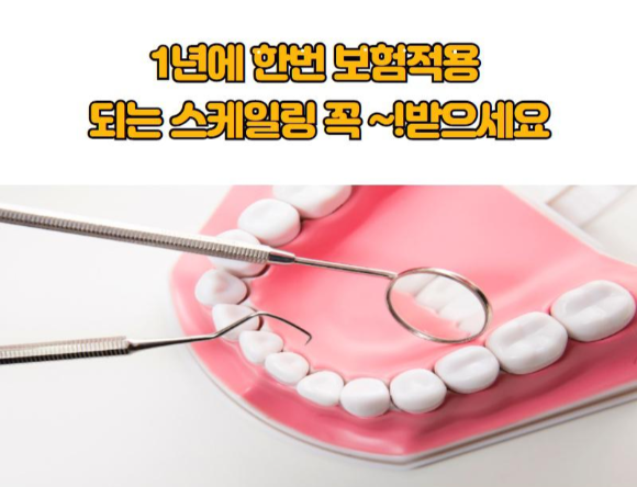  스케일링 보험적용 되니 치아관리 하세요~!!!