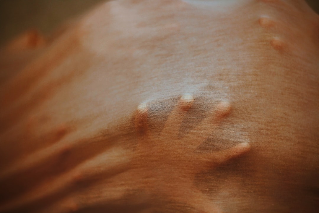 Swelling